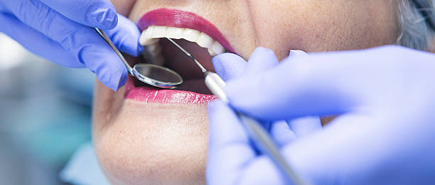 Best Emergency Tooth Extraction in Stepney, CT